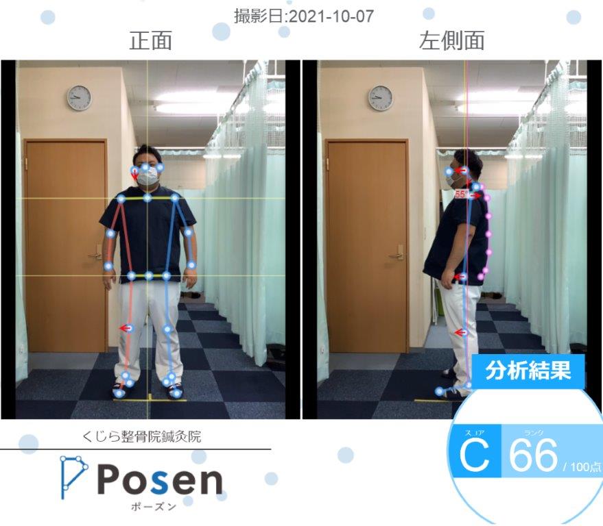 AIによる姿勢分析POSEN導入 | ケアファクトリーグループ